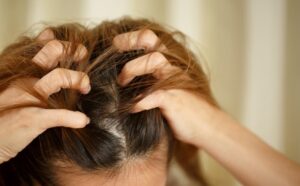 What are the Side Effects of a Hair Transplant Woman?